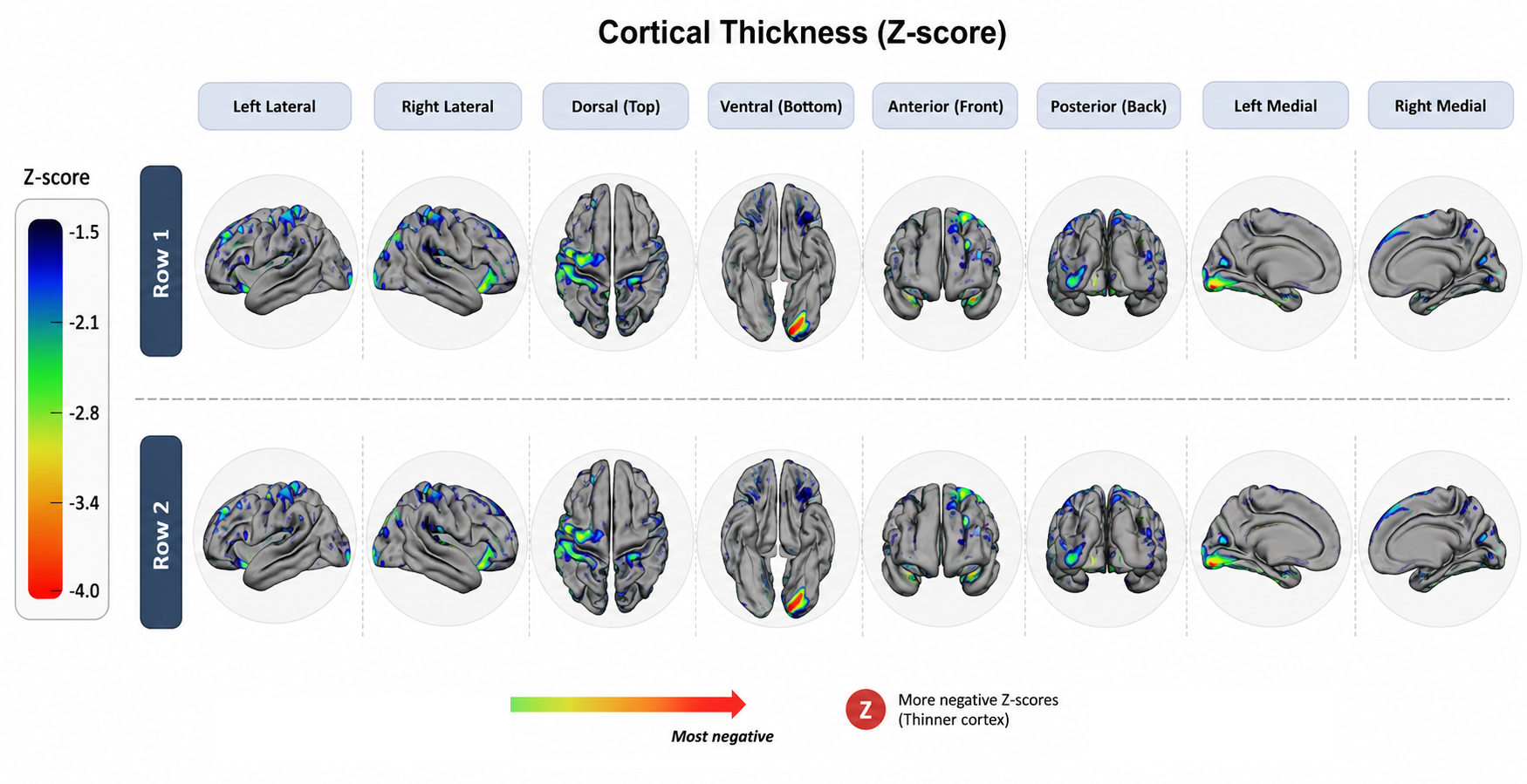 Cortical thickness estimation maps